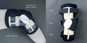 Mixo-suit knee component product anatomy