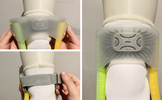 Mixo-suit prototype knee brace details